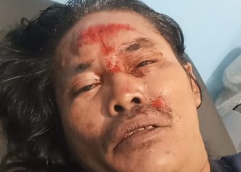 Diduga Akibat Berita, Seorang Wartawan di Taput di Aniaya Oknum Kades