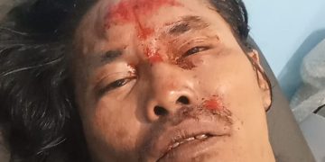 Diduga Akibat Berita, Seorang Wartawan di Taput di Aniaya Oknum Kades